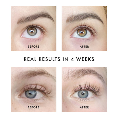 Lash & Brow Boosting Serum (12ml)